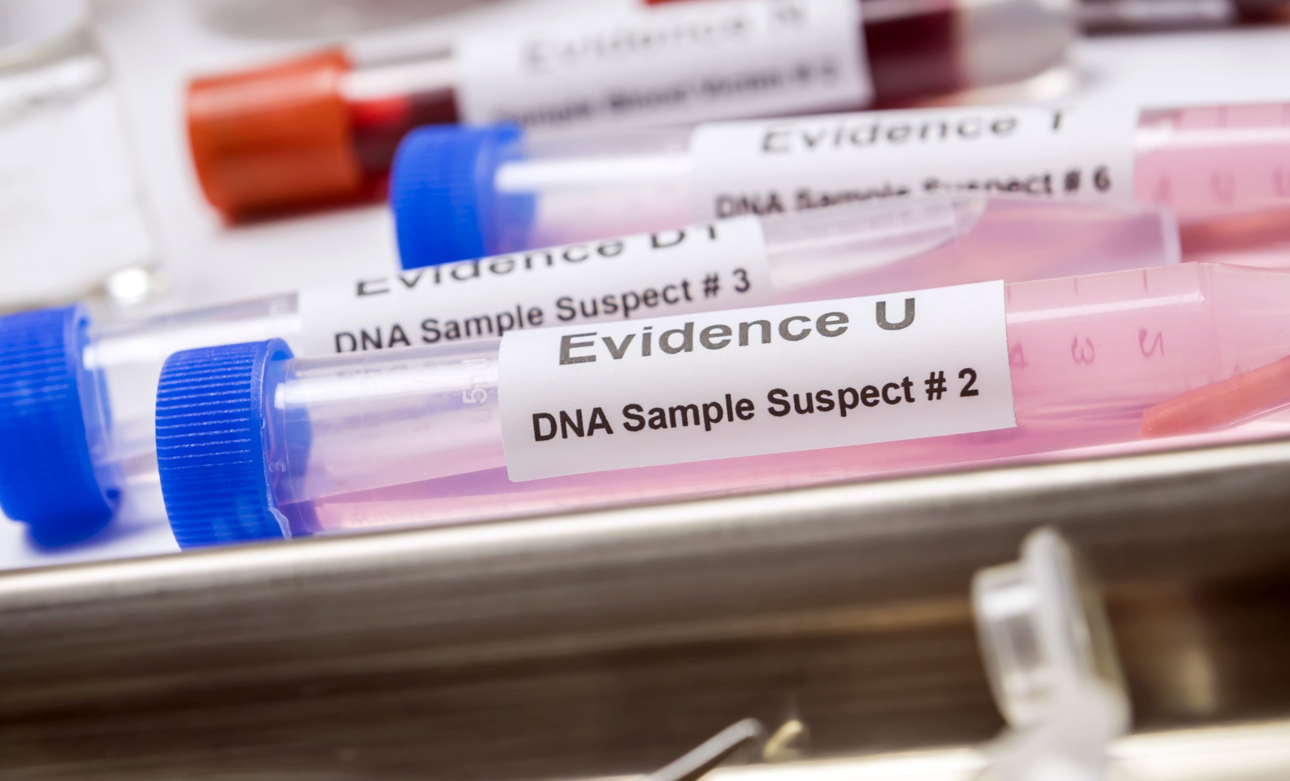 hematological-analysis-with-forensic-test-kit-in-a-2023-11-27-05-13-00-utc-1-scaled.jpg